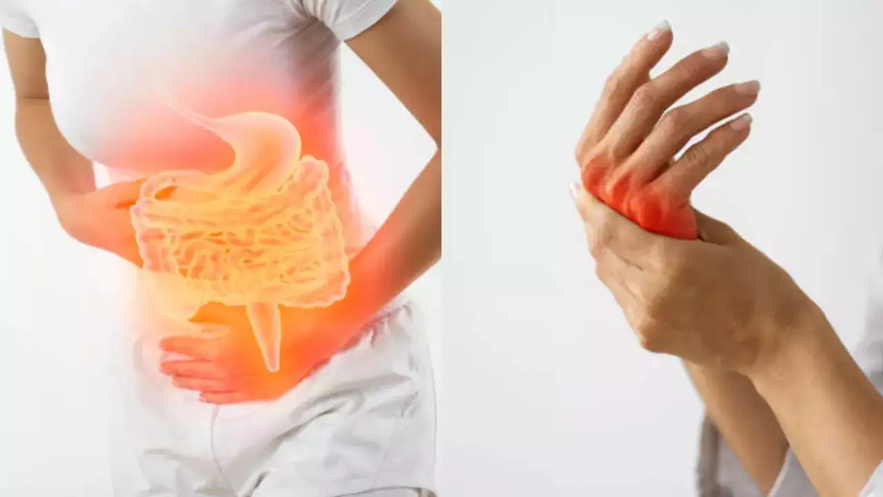 An Imbalanced Gut Triggers Painful Rheumatoid Arthritis; Here's How