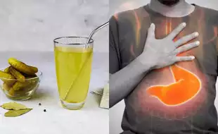 This Tangy, Delicious Drink Can Help Relieve Your Acid Reflux In Minutes; Know How Pickle Juice Regulates Digestion