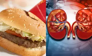 US Teen With E. coli Battling Kidney Failure After Eating McDonald’s Quarter Pounders; Know How The Pathogen Affects Organs