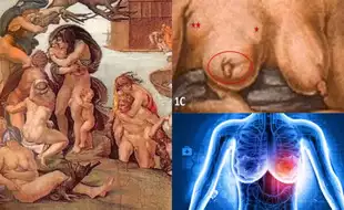 Michaelangelo's Famous 16th Century Artwork Genesis Depicts THIS Deadly, Modern-day Disease