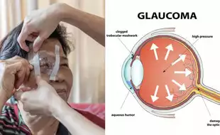 World Diabetes Day 2024: How Do High Blood Sugar Levels Put You At The Risk of This Dreadful Eye Condition?