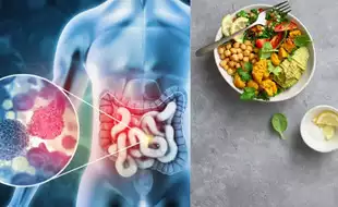 Healthiest Foods To Prevent Colorectal Cancer In Gen Z