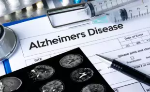 Alzheimer’s Symptoms: Know The Six Early Signs Of The Disorder That Can Help In Early Diagnosis