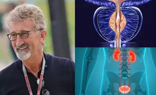 F1 Legend Eddie Jordan Reveals `Aggressive’ Prostate And Bladder Cancer; Know How To Catch Them Early