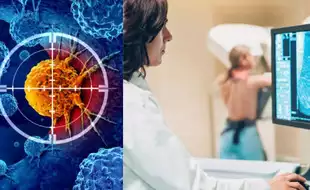 Top 5 Cancer Screenings That Should be on Your Radar in 2025