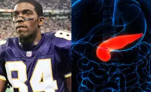 What Is Bile Duct Cancer American NFL Legend Randy Moss Is Battling?