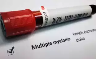 AIIMS Doctors In Process Of Developing Low-Cost Cellular Therapy For Multiple Myeloma