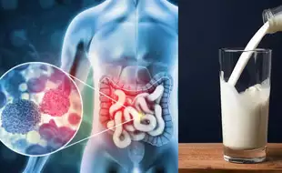 Do Not Ditch The Dairy: A Daily Glass of Milk Slashes The Risk of Bowel Cancer