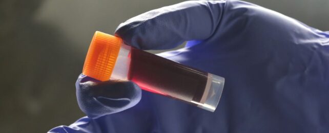 World's First Blood Test For Endometriosis Step Closer Following Trial Success